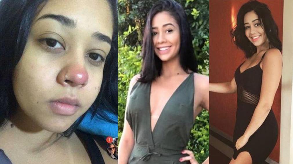 Se hizo un piercing en la nariz y terminó en silla de ruedas