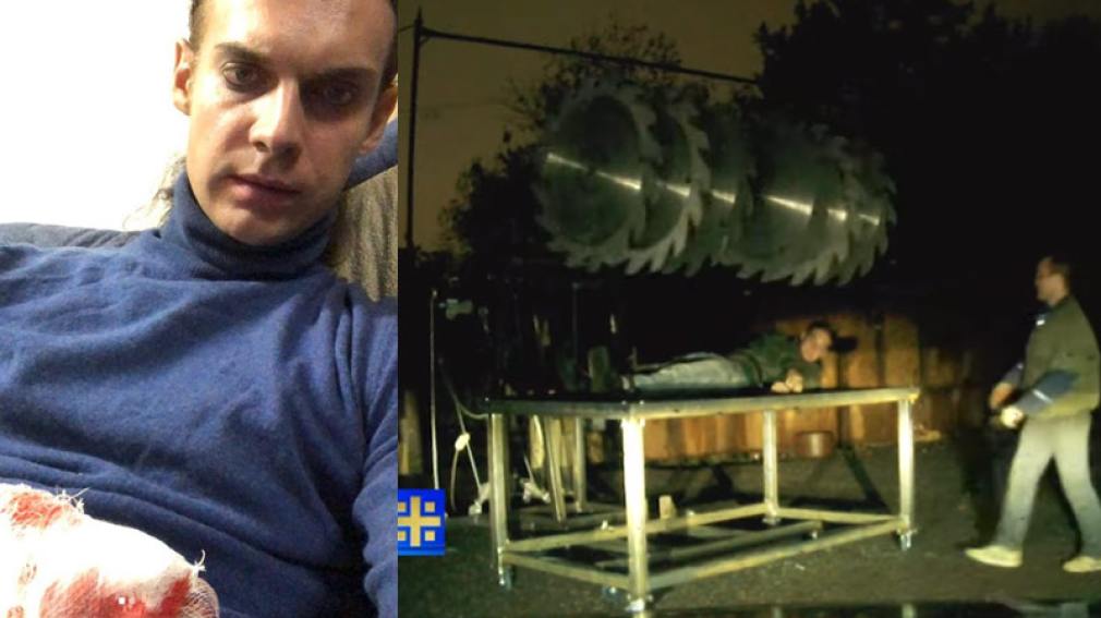 Ilusionista ruso escapa con graves heridas en su mano de la “Mesa de la Muerte”